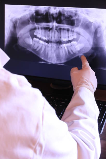Best Emergency Dentist for Lost Fillings or Crowns in Charlotte Harbor, FL